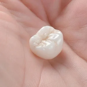 Dental Crown for Broken Tooth cap