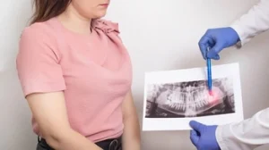 Can You Have Surgery with a Broken Tooth infection Can You Have Surgery with a Broken Tooth infection